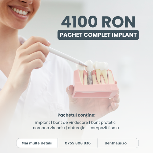 implant dentar Brasov